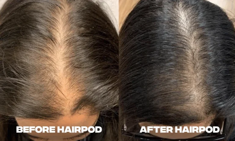 before-after-hair-loss-woman