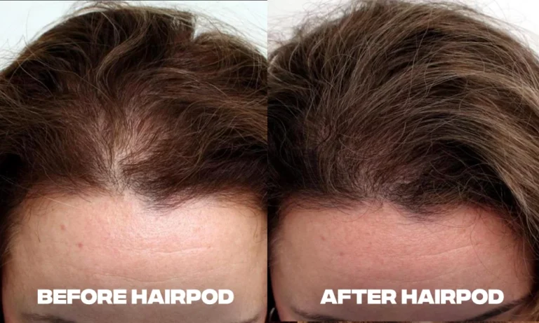 new_before_after_hairpod_copy_9ca39192-afed-48a1-a532-354b2c8ed3bf